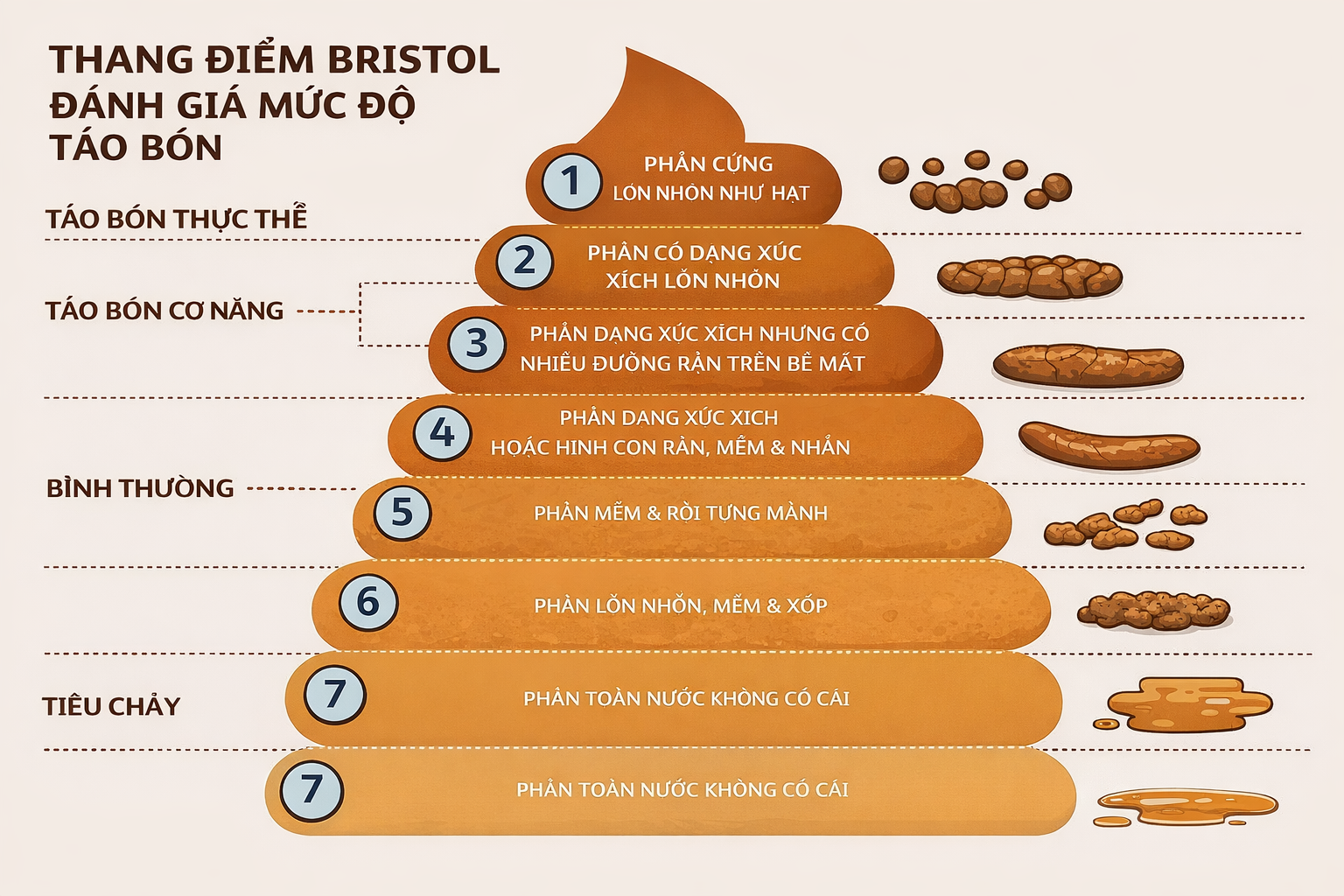 Phân cứng, khô theo thang Bristol là dấu hiệu táo bón chức năng